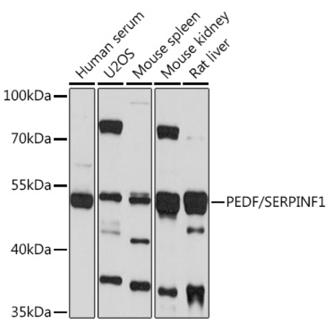 PEDF/SERPINF1 Rabbit Polyclonal Antibody