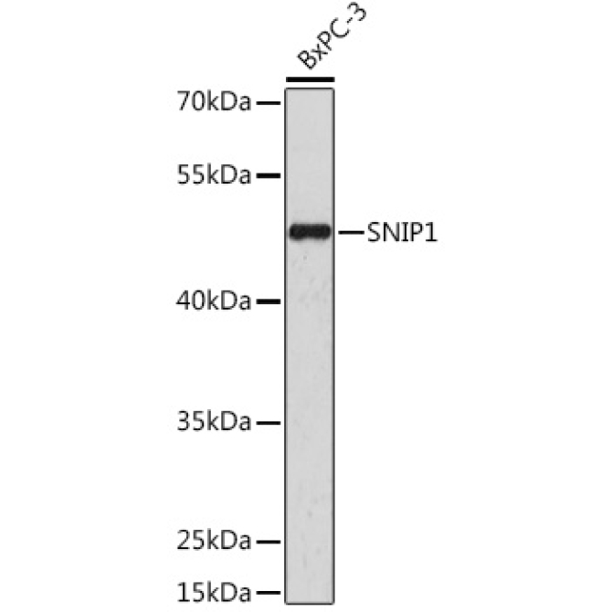 SNIP1 Rabbit Polyclonal Antibody
