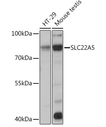 SLC22A5 Rabbit Polyclonal Antibody