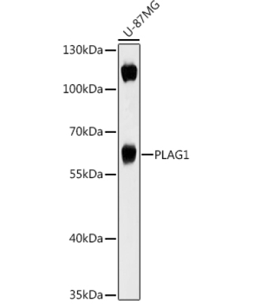 PLAG1 Rabbit Polyclonal Antibody