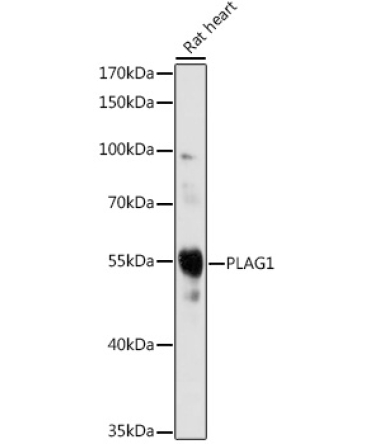 PLAG1 Rabbit Polyclonal Antibody