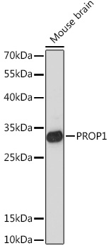 PROP1 Rabbit Polyclonal Antibody