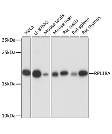 RPL18A Rabbit Polyclonal Antibody