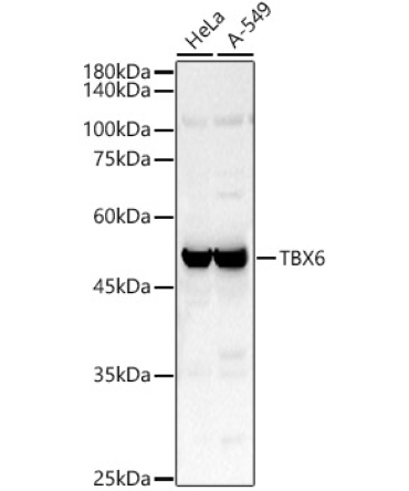 TBX6 Rabbit Polyclonal Antibody