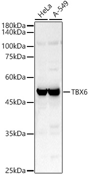 TBX6 Rabbit Polyclonal Antibody