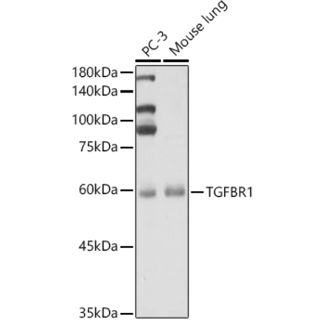 TGF beta Receptor I (TGFBR1) Rabbit Polyclonal Antibody