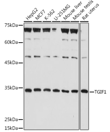 TGIF1 Rabbit Polyclonal Antibody