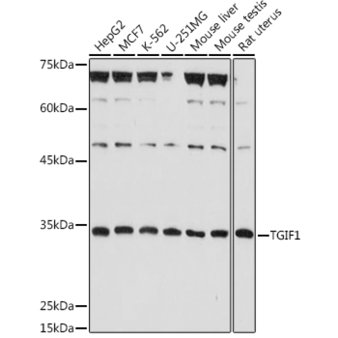 TGIF1 Rabbit Polyclonal Antibody