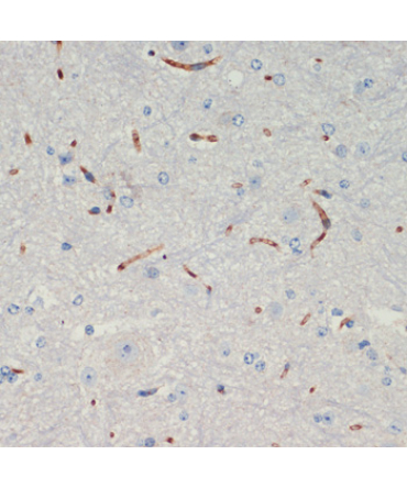 THBS1 Rabbit Polyclonal Antibody
