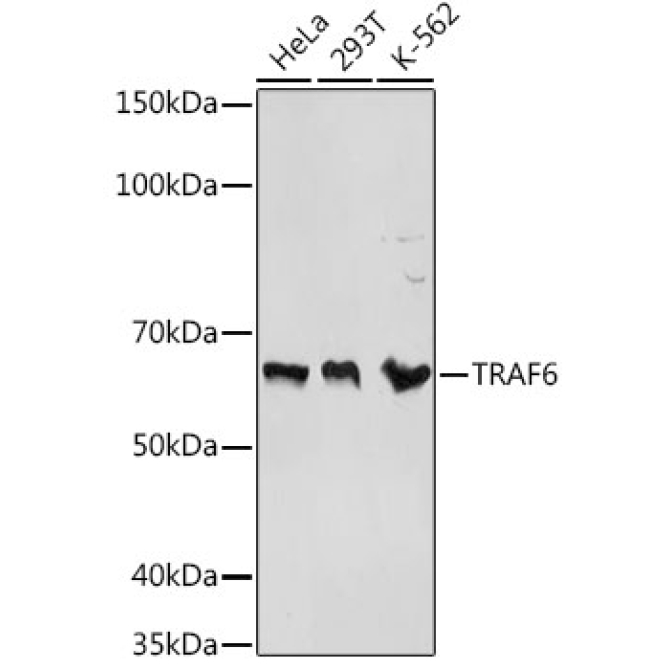 TRAF6 Rabbit Polyclonal Antibody