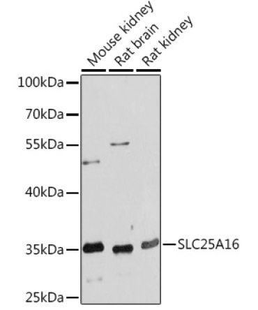 SLC25A16 Rabbit Polyclonal Antibody