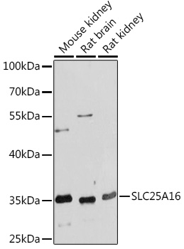 SLC25A16 Rabbit Polyclonal Antibody