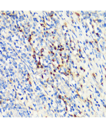TNFSF11 Rabbit Polyclonal Antibody