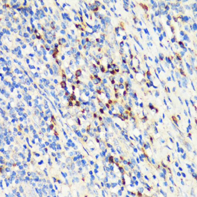 TNFSF11 Rabbit Polyclonal Antibody