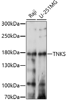 TNKS Rabbit Polyclonal Antibody
