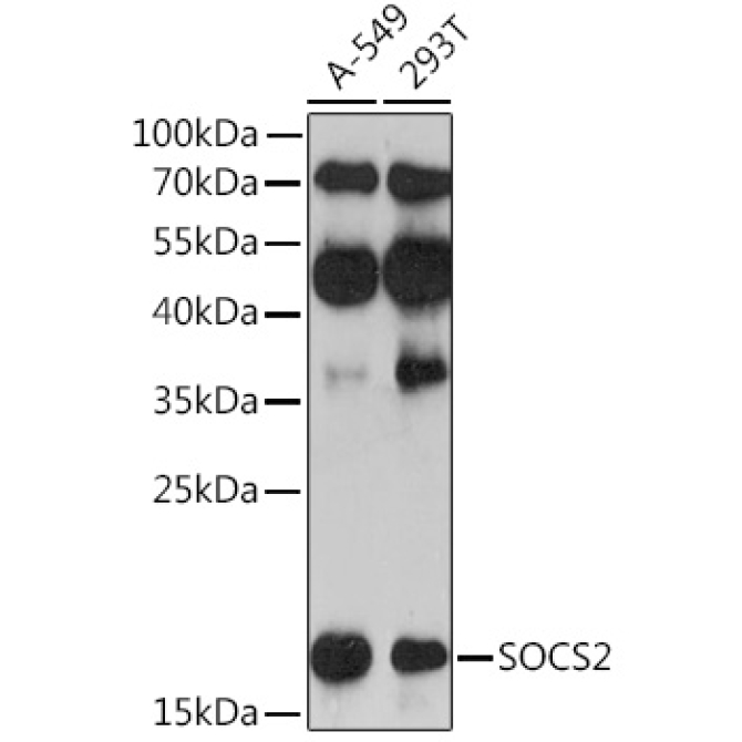 SOCS2 Rabbit Polyclonal Antibody