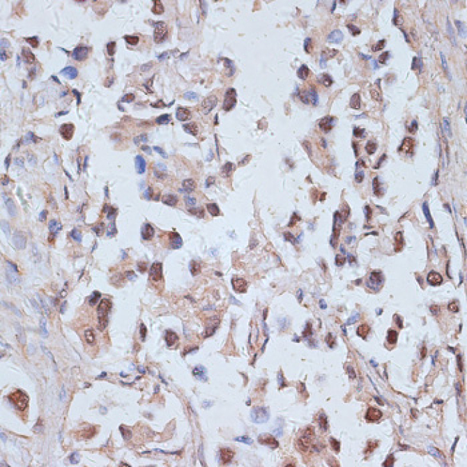 TRAF6BP/TAX1BP1 Rabbit Polyclonal Antibody