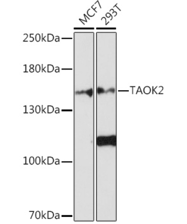 TAOK2 Rabbit Polyclonal Antibody