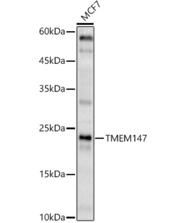 TMEM147 Rabbit Polyclonal Antibody