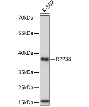 RPP38 Rabbit Polyclonal Antibody