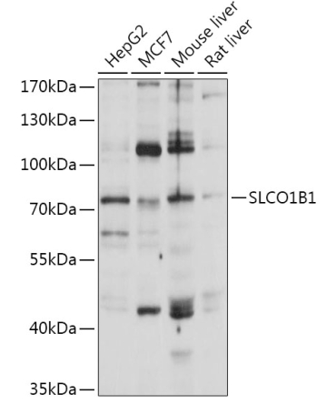 SLCO1B1 Rabbit Polyclonal Antibody
