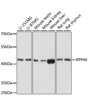 RPP40 Rabbit Polyclonal Antibody