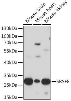 SRSF8 Rabbit Polyclonal Antibody