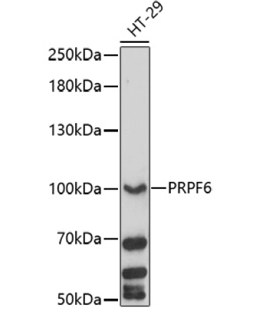 PRPF6 Rabbit Polyclonal Antibody