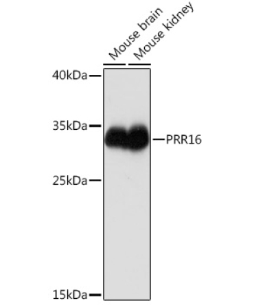 PRR16 Rabbit Polyclonal Antibody