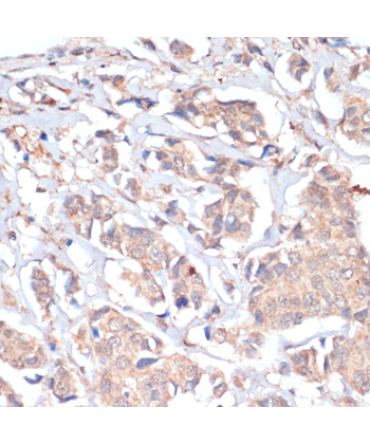 PRMT7 Rabbit Polyclonal Antibody