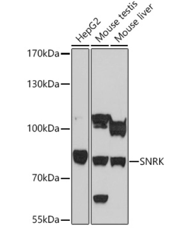 SNRK Rabbit Polyclonal Antibody