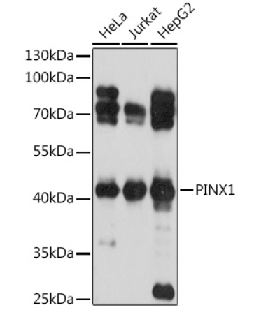 PINX1 Rabbit Polyclonal Antibody