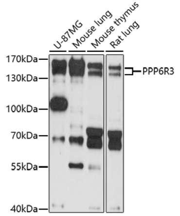 PPP6R3 Rabbit Polyclonal Antibody