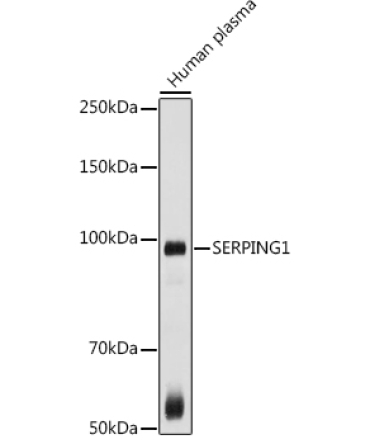 SERPING1 Rabbit Polyclonal Antibody
