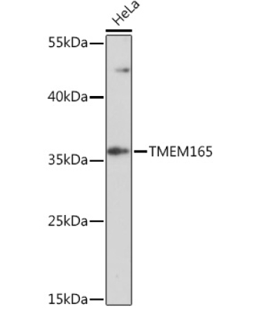 TMEM165 Rabbit Polyclonal Antibody