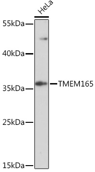TMEM165 Rabbit Polyclonal Antibody