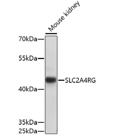 SLC2A4RG Rabbit Polyclonal Antibody