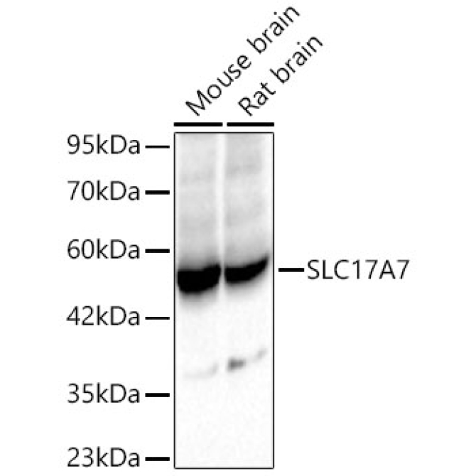 SLC17A7 Rabbit Polyclonal Antibody