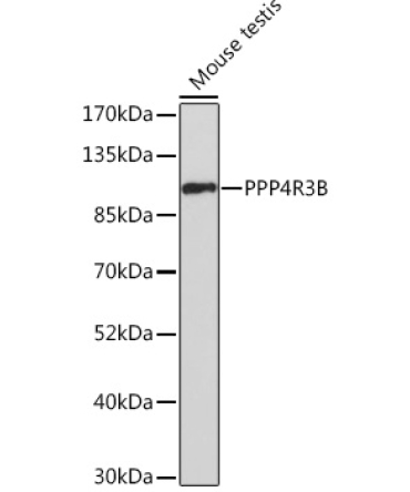 PPP4R3B Rabbit Polyclonal Antibody