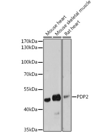 PDP2 Rabbit Polyclonal Antibody