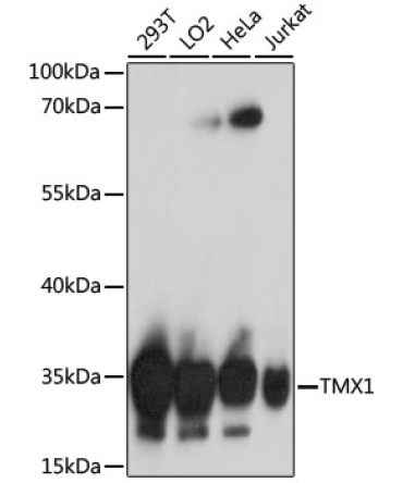 TMX1 Rabbit Polyclonal Antibody