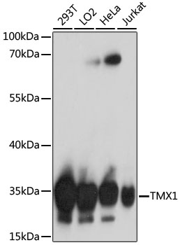 TMX1 Rabbit Polyclonal Antibody