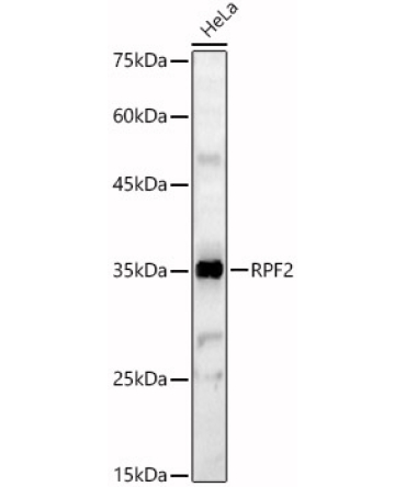 RPF2 Rabbit Polyclonal Antibody