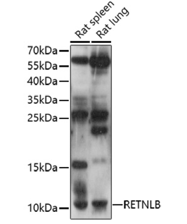 RETNLB Rabbit Polyclonal Antibody