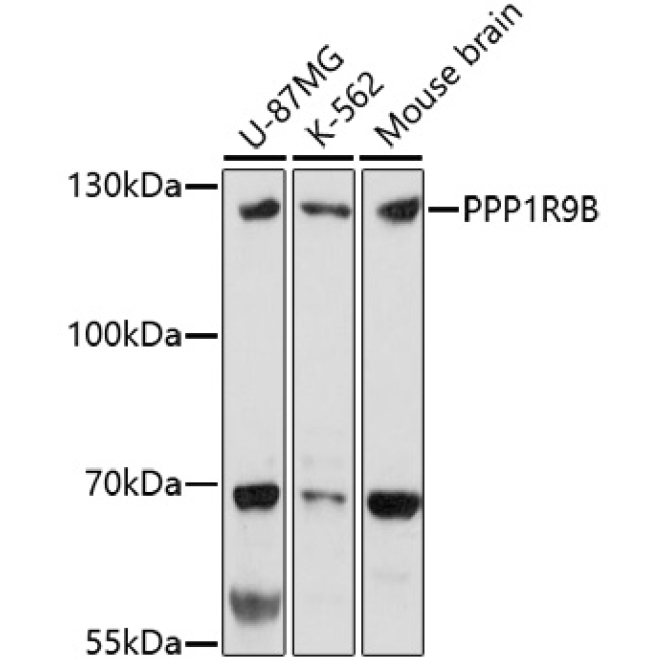 PPP1R9B Rabbit Polyclonal Antibody