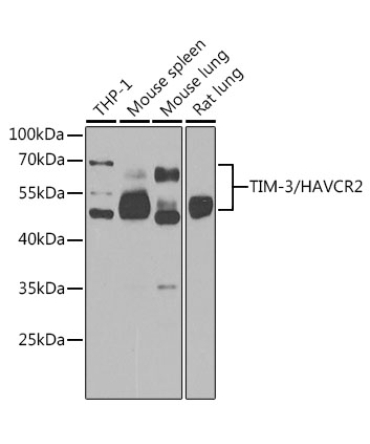 TIM-3/HAVCR2 Rabbit Polyclonal Antibody