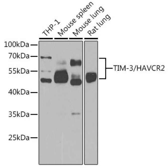 TIM-3/HAVCR2 Rabbit Polyclonal Antibody