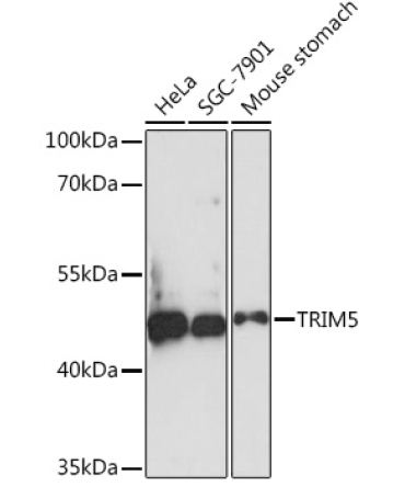 TRIM5 Rabbit Polyclonal Antibody