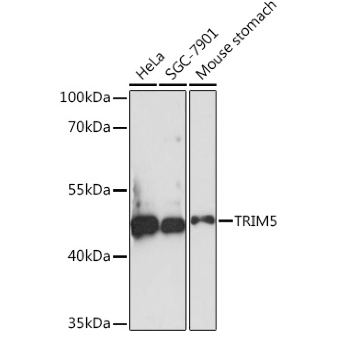 TRIM5 Rabbit Polyclonal Antibody