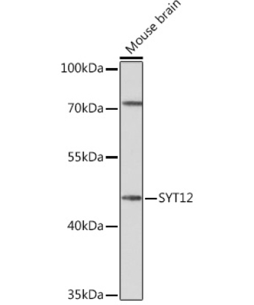 SYT12 Rabbit Polyclonal Antibody